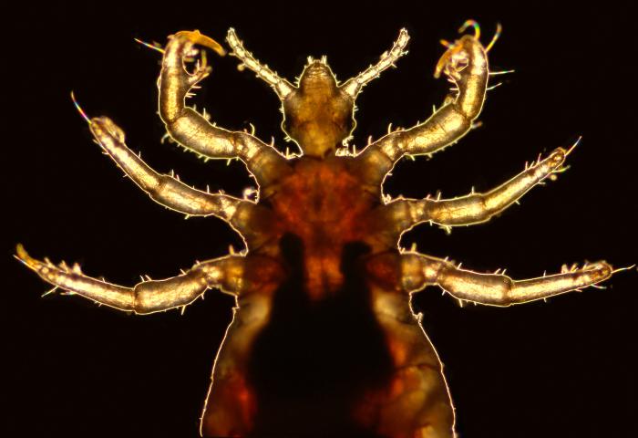 Magnified photograph of ventral view of a male body louse, Pediculus humanus var. corporis, focusing on the insects cephalic and thoracic regions. From Public Health Image Library (PHIL). [1]