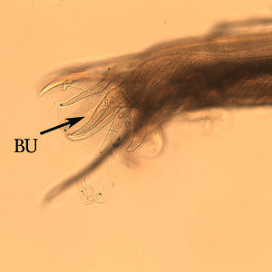 File:Oesophagostomum BAM bursa2.jpg