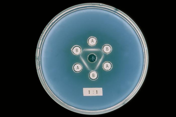 Actinomyces sp. From Public Health Image Library (PHIL). [1]