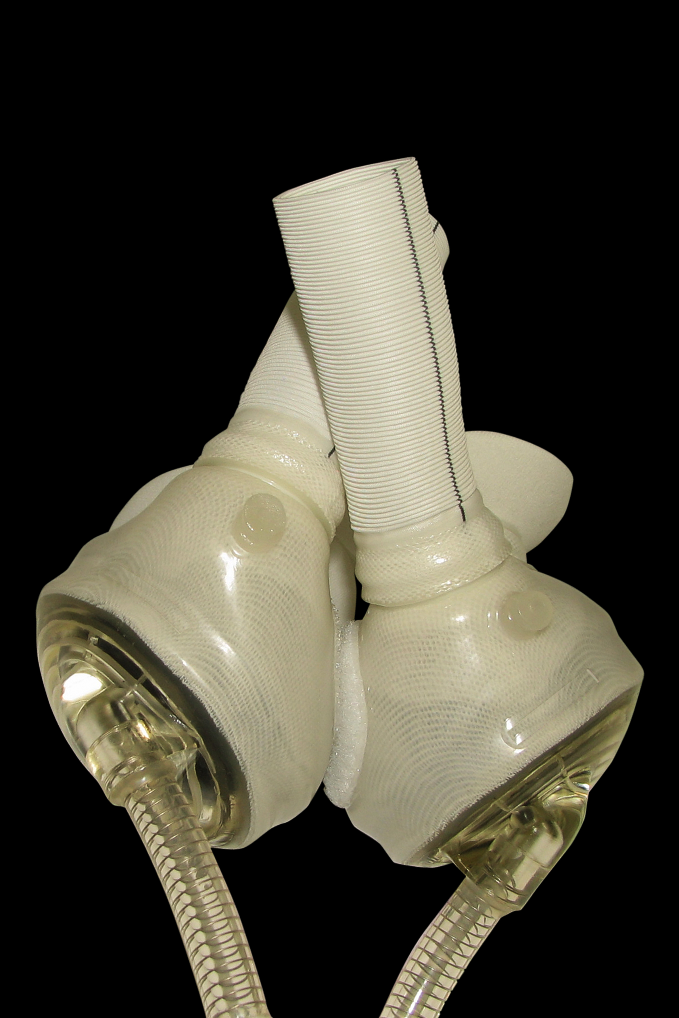 The CardioWest™ temporary Total Artificial Heart