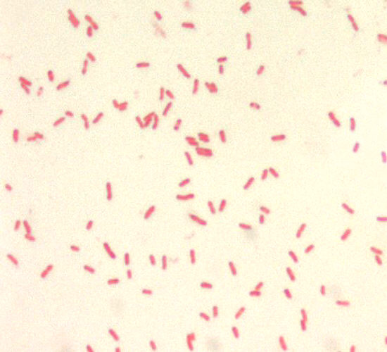 Yersinia pestis, Gram-negative bacillus, 1000x Magnification Adapted from Public Health Image Library (PHIL), Centers for Disease Control and Prevention.[19]