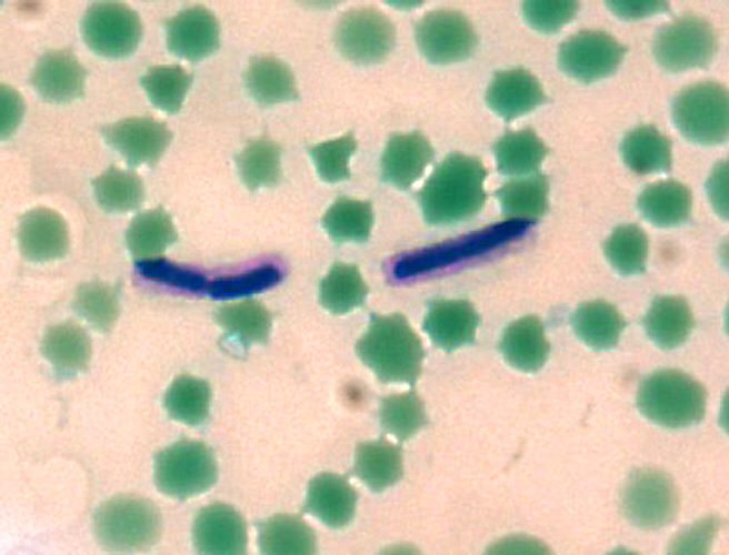 "Bacillus anthracis M'Fadyean capsule stain”Adapted from Public Health Image Library (PHIL), Centers for Disease Control and Prevention.[21]