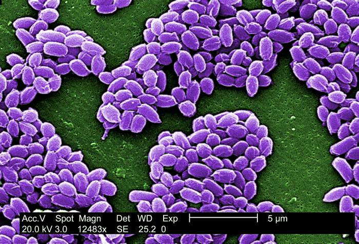 Magnification of 12,483X, this scanning electron micrograph (SEM) depicted spores from the Sterne strain of Bacillus anthracis bacteria.”Adapted from Public Health Image Library (PHIL), Centers for Disease Control and Prevention.[20]