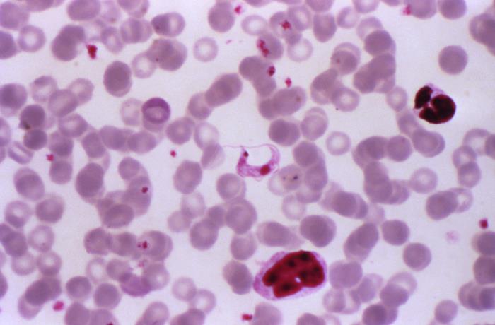 Micrograph revealing Trypanosoma cruzi parasites in a blood smear using Giemsa staining technique (100x mag). From Public Health Image Library (PHIL). [6]