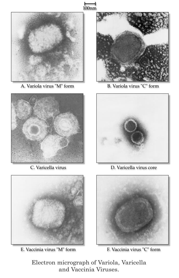 Electron micrographs of Variola, Varicella and Vaccinia virions. From Public Health Image Library (PHIL). [1]