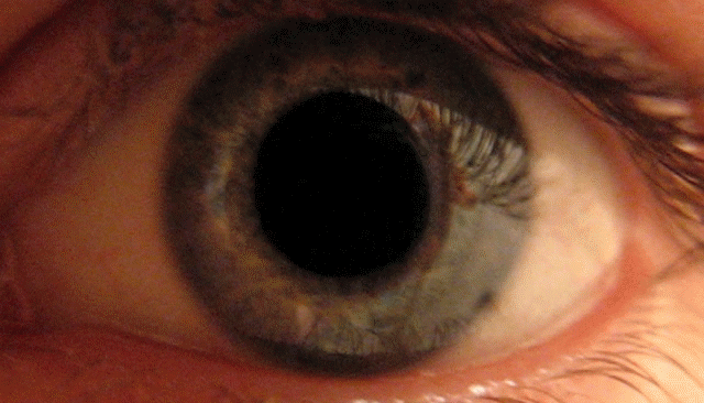 Pupillary response