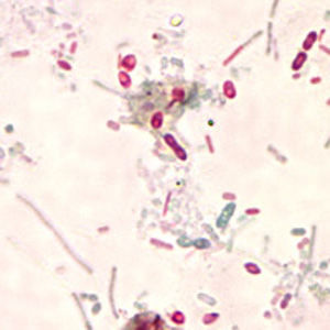 File:Unidentified microsporidia stained with Chromotrope 2R..jpg