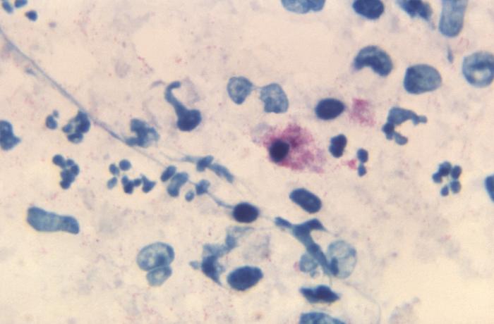 Gram-negative Chlamydophila psittaci bacteria. From Public Health Image Library (PHIL). [2]