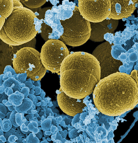 File:Staphylococcus aureus bacteria escape.jpg