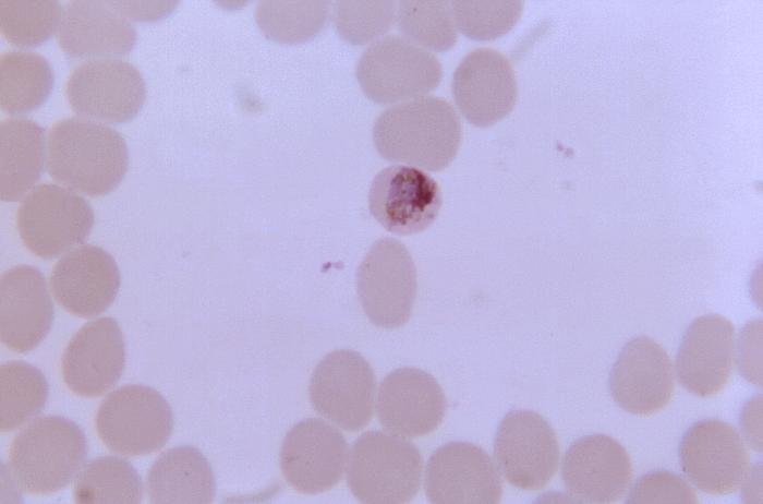 Thin film blood smear micrograph depicts an older, growing Plasmodium malariae trophozoite Adapted from Public Health Image Library (PHIL), Centers for Disease Control and Prevention.[6]