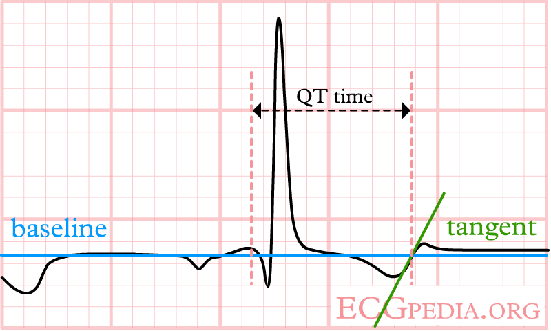 A bifasic T wave. The tangent to the 'hump' with the largest amplitude is chosen. This can change from beat to beat, making it more important to average several measurements.