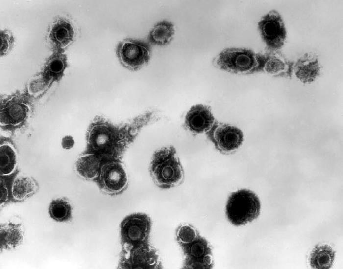 Transmission electron micrograph of varicella-zoster virions from vesicle fluid of patient with chickenpox. From Public Health Image Library (PHIL). [1]