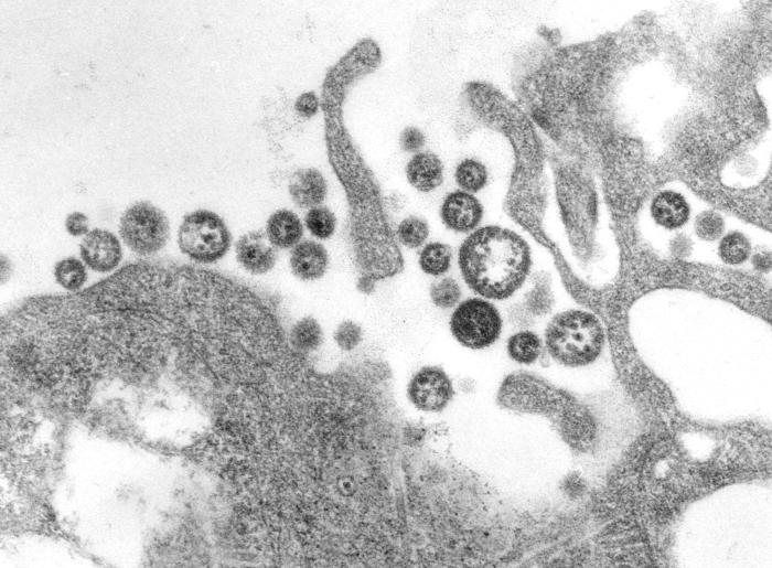 This transmission electron micrograph (TEM) demonstrates Lassa virus virions adjacent to host cell debris.Retrieved from the Public Health Image Library (PHIL), Centers for Disease Control and Prevention.[10]