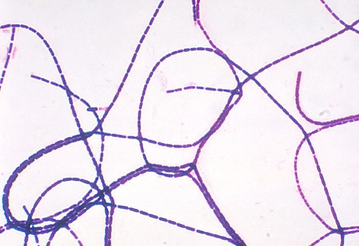 "Photomicrograph demonstrating a positive Gram stain with Bacillus anthracis”Adapted from Public Health Image Library (PHIL), Centers for Disease Control and Prevention.[21]