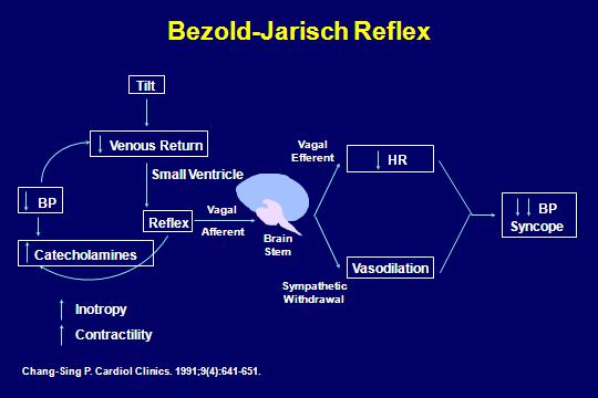 Mechanism of Bezold-Jarisch reflex in syncope