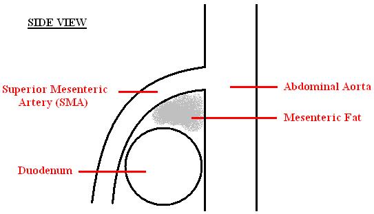 A diagram of a healthy mesenteric angle.