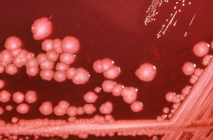 Proteus mirabilis bacteria grown on a xylose-lysine-deoxycholate (XLD) agar plate. From Public Health Image Library (PHIL). [2]