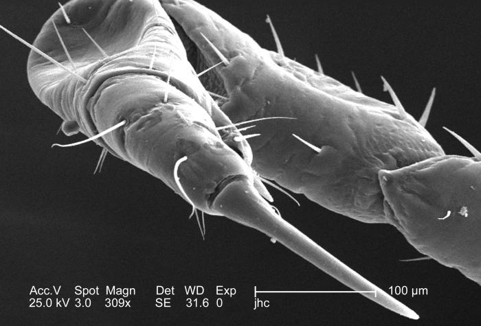 Scanning electron micrograph (SEM) depicted an enlarged dorsal view of the right flexed foreleg of a female body louse, Pediculus humanus var. corporis (309X mag). Leg segments are very stout, and end in claws, which it used to firmly grasp clothing, or a host’s hair shafts. From Public Health Image Library (PHIL). [1]