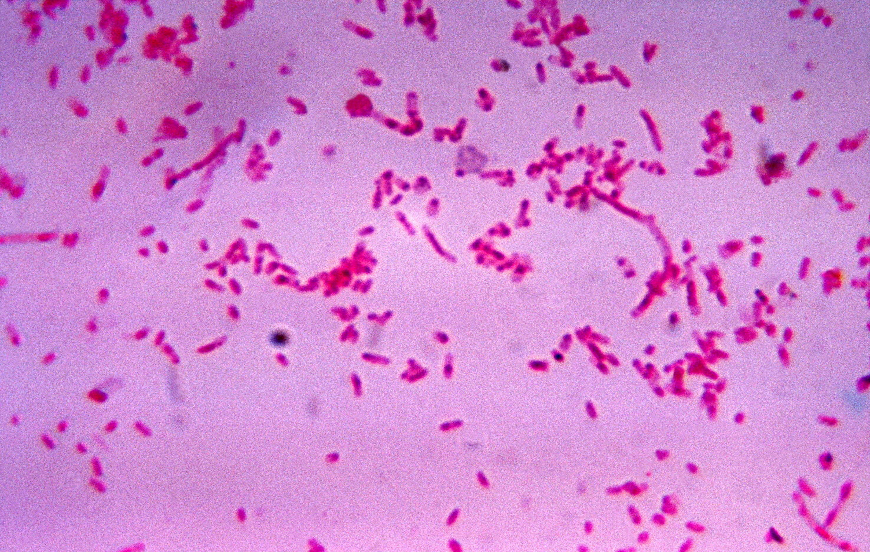 Fusobacterium novum in liquid culture.