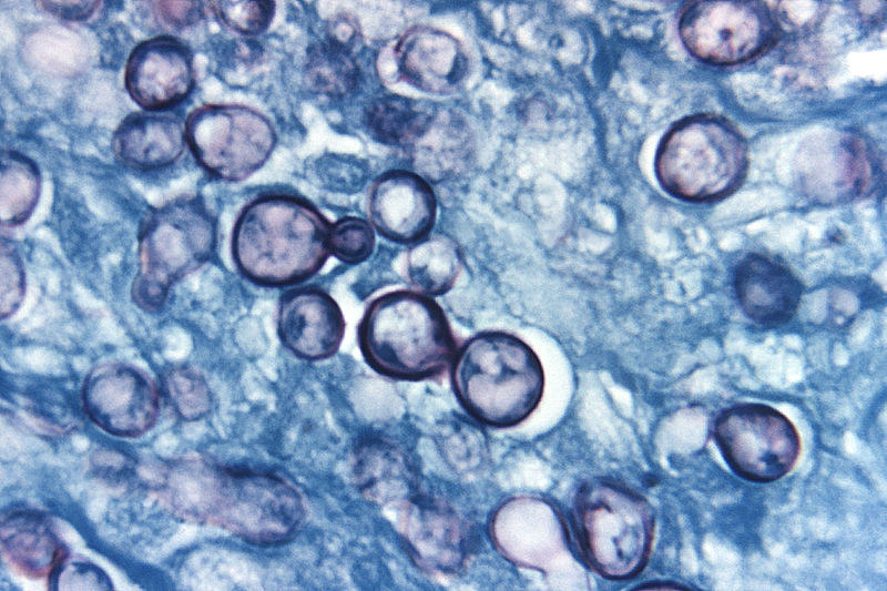 File:Histoplasma capsulatum.jpg