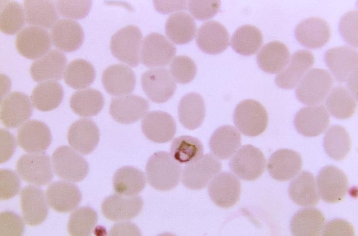 Thin film blood smear micrograph depicts a growing Plasmodium malariae basket-form trophozoite Adapted from Public Health Image Library (PHIL), Centers for Disease Control and Prevention.[6]