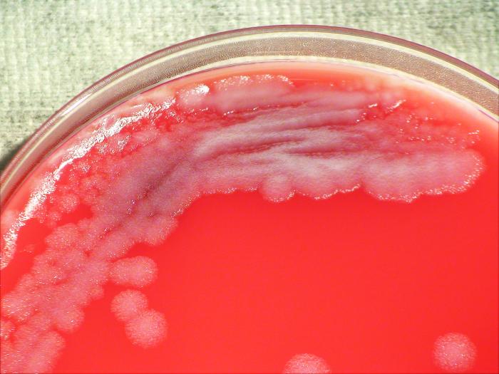 Colonial morphology displayed by Gram-positive, Pasteur strain, Bacillus anthracis bacteria, which was grown on a medium of phenylethyl alcohol agar (PEA), for a 24 hour time period, at a temperature of 37°C”Adapted from Public Health Image Library (PHIL), Centers for Disease Control and Prevention.[20]
