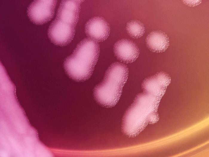 Low-power magnification of 10X of a digital Keyence scope, this photograph depicts the colonial growth displayed by Pasteur strain members of the Gram-positive bacterium, Bacillus anthracis, which were cultured on colistin-naladixic acid agar (CNA) medium, for a 48 hour time period, at a temperature of 37°C. ”Adapted from Public Health Image Library (PHIL), Centers for Disease Control and Prevention.[21]