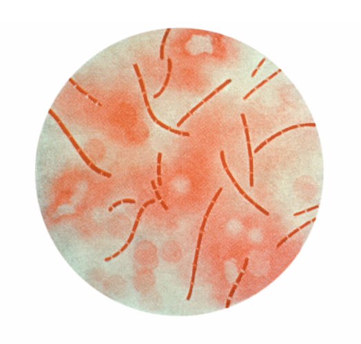 "Photomicrograph of Bacillus anthracis bacteria taken from heart blood, and using Carbol Fuchsin stain.”Adapted from Public Health Image Library (PHIL), Centers for Disease Control and Prevention.[20]