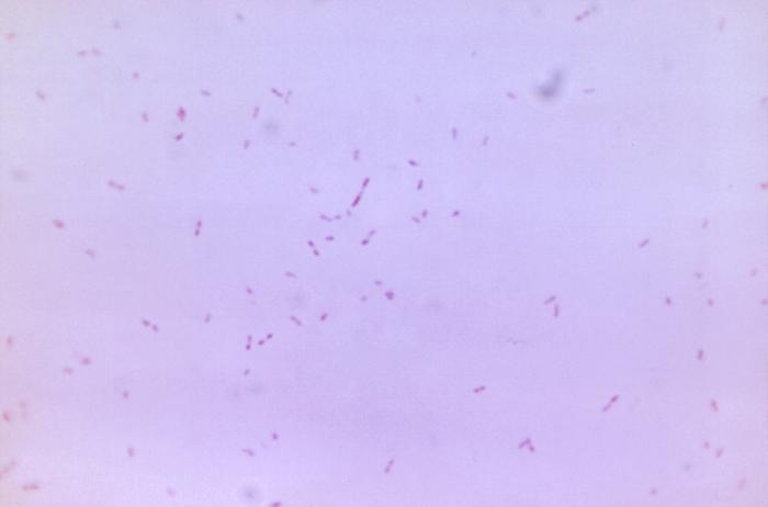 Gram-stained photomicrograph depicted numerous Gram-negative Fusobacterium sp. bacteria (956X mag). From Public Health Image Library (PHIL). [10]