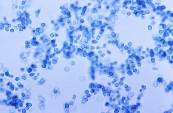 Photomicrograph reveals presence of numerous thick-walled Coccidioides immitis arthroconidia and arthrospores (500x mag). From Public Health Image Library (PHIL). [1]