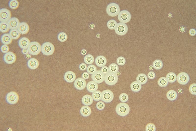 Cryptococcus: clear halo visualized by the india ink stain