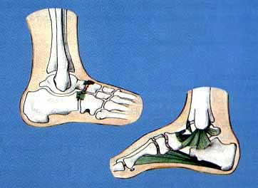 File:Ankle med & lat view.jpg