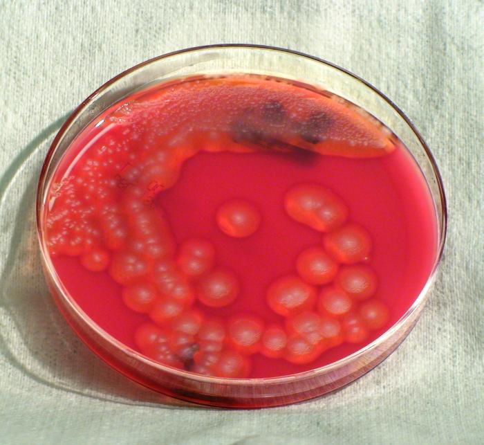 File:Bacillus cereus02.jpeg