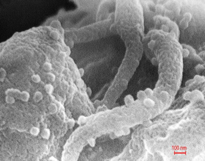 Acinetobacter. From Public Health Image Library (PHIL). [28]