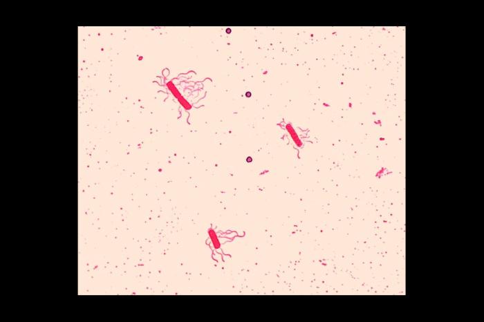 File:Bacillus cereus08.jpeg