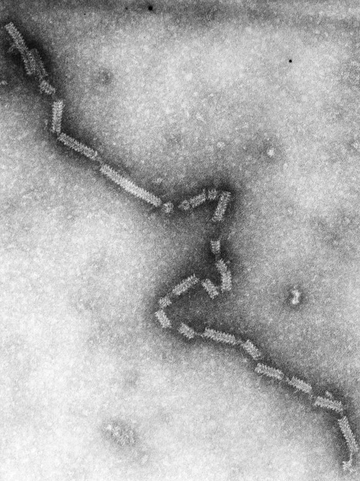 This transmission electron micrograph (TEM) revealed some of the nucleocapsid morphologic features displayed by the human parainfluenza virus Type-4a (HPIV-4), a member of the Paramyxoviridae family. From Public Health Image Library (PHIL). [1]