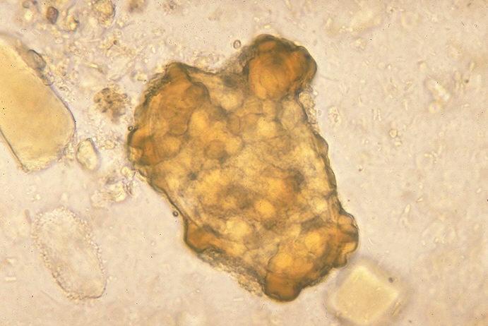 Infertile egg of Ascaris lumbricoides. From Public Health Image Library (PHIL). [6]