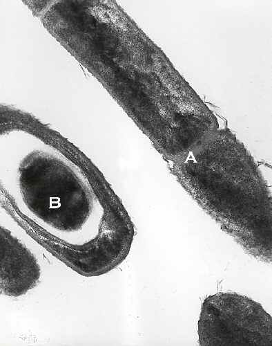 "Transmission electron micrograph of Bacillus anthracis”Adapted from Public Health Image Library (PHIL), Centers for Disease Control and Prevention.[20]
