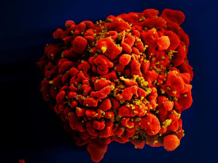 Digitally-colorized scanning electron micrograph (SEM) depicts a single, red-colored H9-T cell that had been infected by numerous, spheroid-shaped, mustard-colored human immunodeficiency virus (HIV) particles. From Public Health Image Library (PHIL). [28]