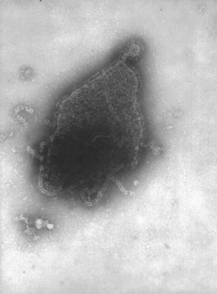 This transmission electron micrograph (TEM) revealed the presence of the human parainfluenza type 4A virus (HPIV-4A), which like the mumps virus, is also a Paramyxoviridae family member, and a member of the genus, Rubulavirus. From Public Health Image Library (PHIL). [1]