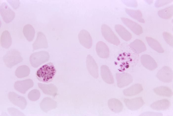 Magnified 1125X, this thin film photomicrograph of a blood smear, revealed the presence of twoPlasmodium vivax schizonts, an immature form on the left, and a mature form on the right. Merozoites are undergoing development in these two infected erythrocytes, and they are almost ready to be liberated from the mature schizont. Adapted from Public Health Image Library (PHIL), Centers for Disease Control and Prevention.[6]