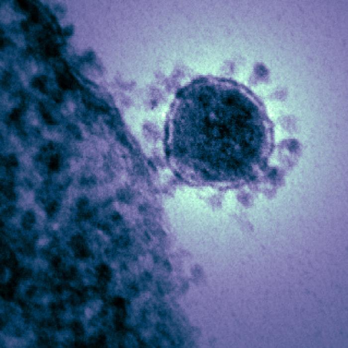 TEM reveals ultrastructural details exhibited by a single, spherical-shaped Middle East Respiratory Syndrome Coronavirus (MERS-CoV) virion. From Public Health Image Library (PHIL). [1]