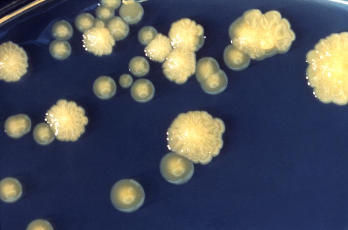 Agar culture plate grew colonies of Enterobacter cloacae that were both characteristically rough and smooth in appearance.. From Public Health Image Library (PHIL). [1]