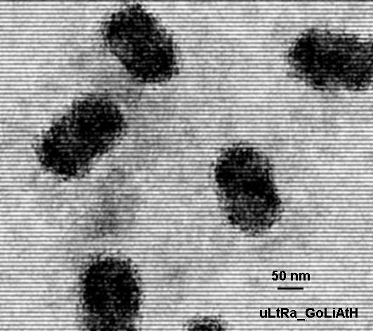 EM of Molluscum contagiosum virus