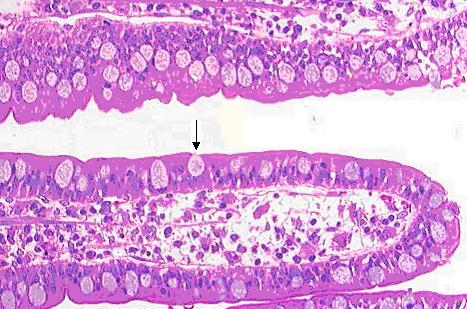 Goblet cell in ileum
