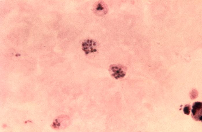 Thick film Giemsa stained micrograph showing two mature Plasmodium vivax schizonts each containing merozoites Adapted from Public Health Image Library (PHIL), Centers for Disease Control and Prevention.[6]