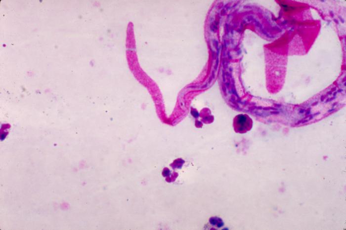 Micrograph of the posterior end of a Brugia malayi microfilaria in a thick blood smear using Giemsa stain. From Public Health Image Library (PHIL). [2]