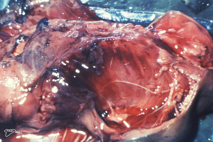 Photograph depicts aborted fetal ruminant necropsy, revealing numerous hemorrhages, and a hemothorax (blood within the thoracic cavity). From Public Health Image Library (PHIL). [2]