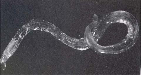File:Oesophagostomum larva (micrograph).jpg