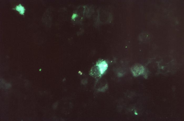 Photomicrograph prepared using direct fluorescent antibody staining technique reveals positive staining for the presence of Chlamydophila psittaci (400x mag). From Public Health Image Library (PHIL). [1]